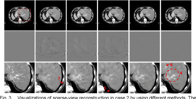 Figure 4 for Multi-domain Integrative Swin Transformer network for Sparse-View Tomographic Reconstruction