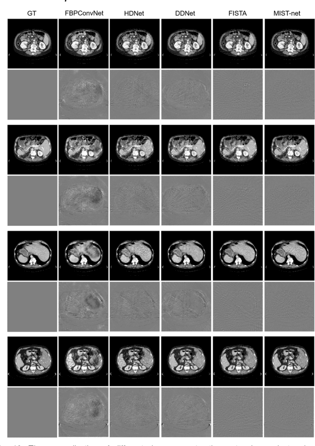 Figure 2 for Multi-domain Integrative Swin Transformer network for Sparse-View Tomographic Reconstruction