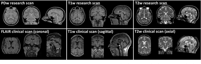 Figure 1 for A Tool for Super-Resolving Multimodal Clinical MRI