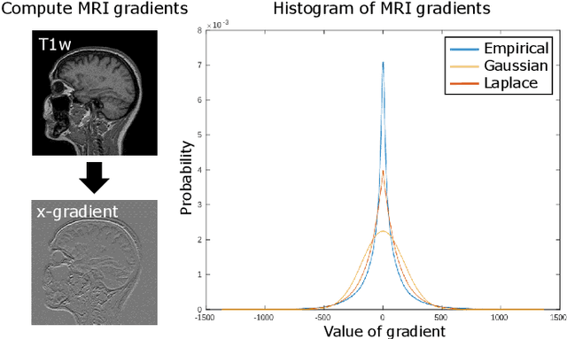 Figure 4 for A Tool for Super-Resolving Multimodal Clinical MRI