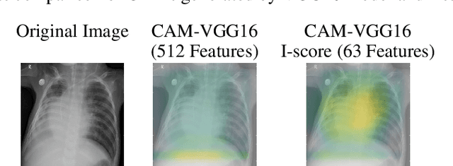 Figure 3 for A Novel Interaction-based Methodology Towards Explainable AI with Better Understanding of Pneumonia Chest X-ray Images