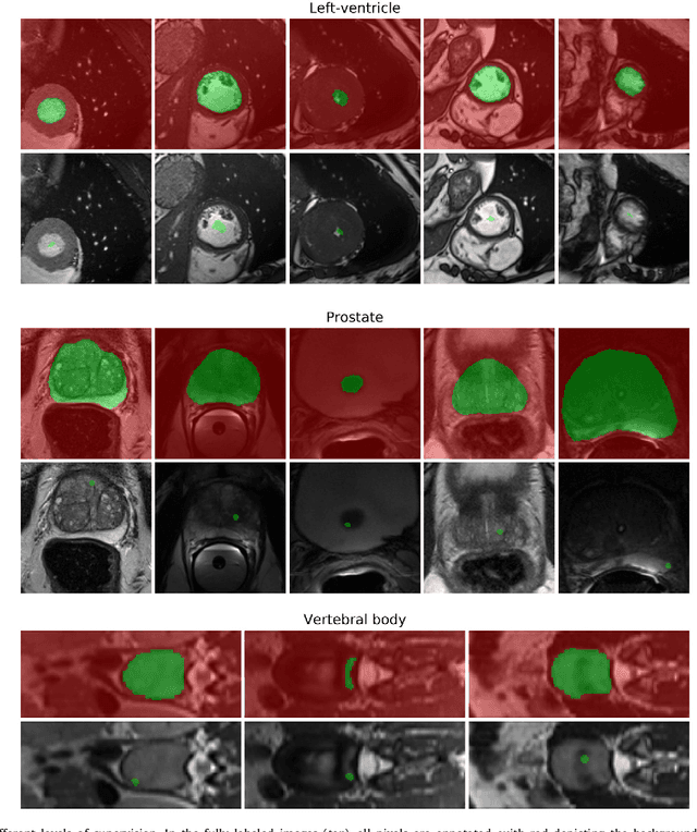 Figure 2 for Constrained-CNN losses forweakly supervised segmentation