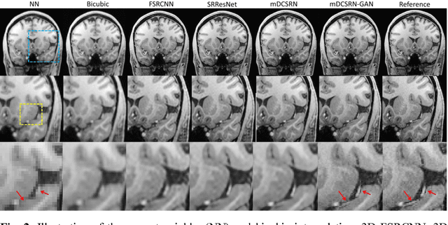 Figure 3 for Efficient and Accurate MRI Super-Resolution using a Generative Adversarial Network and 3D Multi-Level Densely Connected Network