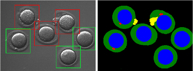 Figure 1 for Automatic evaluation of human oocyte developmental potential from microscopy images