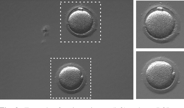 Figure 4 for Automatic evaluation of human oocyte developmental potential from microscopy images