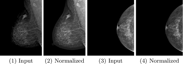 Figure 3 for Photometric Transformer Networks and Label Adjustment for Breast Density Prediction