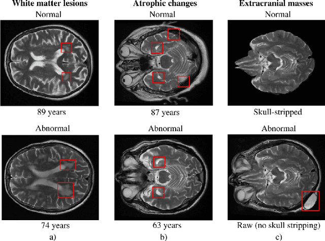 Figure 1 for Automated triaging of head MRI examinations using convolutional neural networks