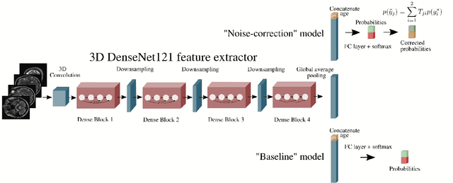Figure 3 for Automated triaging of head MRI examinations using convolutional neural networks