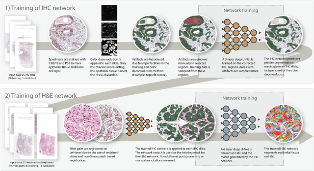 Figure 1 for Epithelium segmentation using deep learning in H&E-stained prostate specimens with immunohistochemistry as reference standard