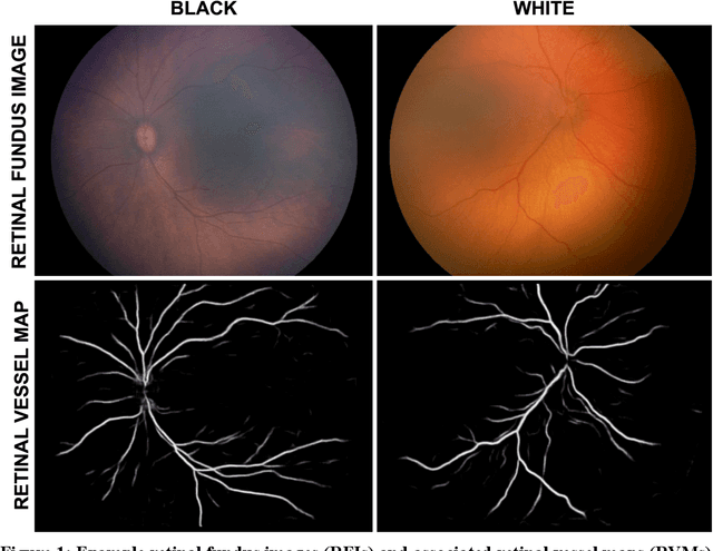 Figure 1 for Not Color Blind: AI Predicts Racial Identity from Black and White Retinal Vessel Segmentations