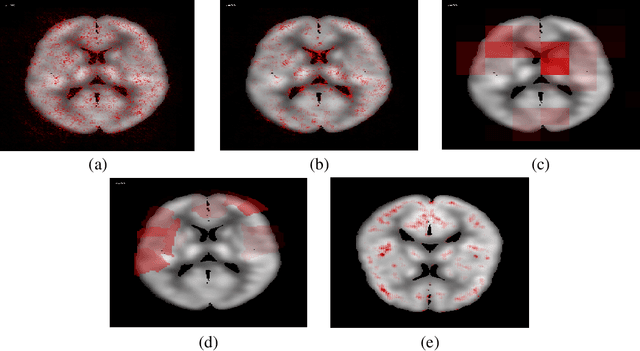 Figure 3 for Understanding 3D CNN Behavior for Alzheimer's Disease Diagnosis from Brain PET Scan
