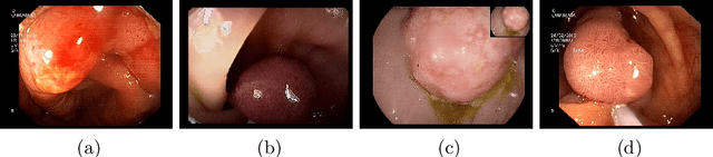 Figure 1 for A Hierarchical Multi-Task Approach to Gastrointestinal Image Analysis