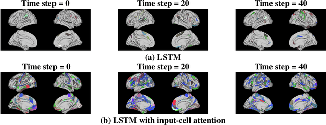 Figure 1 for Input-Cell Attention Reduces Vanishing Saliency of Recurrent Neural Networks