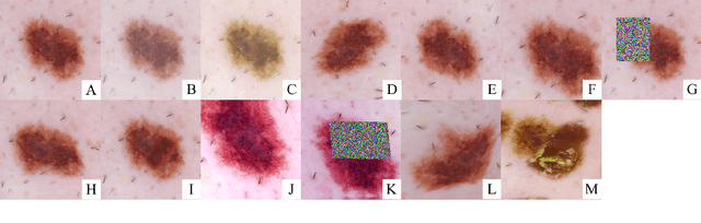 Figure 1 for Data Augmentation for Skin Lesion Analysis