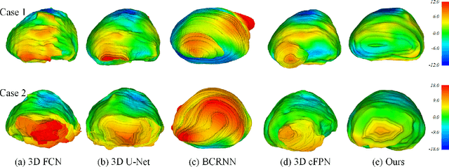 Figure 2 for Deep Attentive Features for Prostate Segmentation in 3D Transrectal Ultrasound