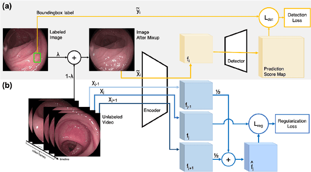 Figure 3 for Colonoscopy Polyp Detection: Domain Adaptation From Medical Report Images to Real-time Videos