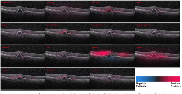 Figure 3 for Quantitative and Qualitative Evaluation of Explainable Deep Learning Methods for Ophthalmic Diagnosis