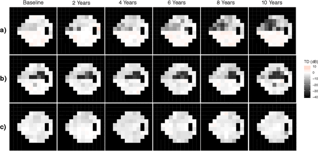Figure 1 for Scalable Modeling of Spatiotemporal Data using the Variational Autoencoder: an Application in Glaucoma
