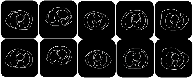 Figure 2 for Image Synthesis for Data Augmentation in Medical CT using Deep Reinforcement Learning