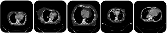 Figure 3 for Image Synthesis for Data Augmentation in Medical CT using Deep Reinforcement Learning