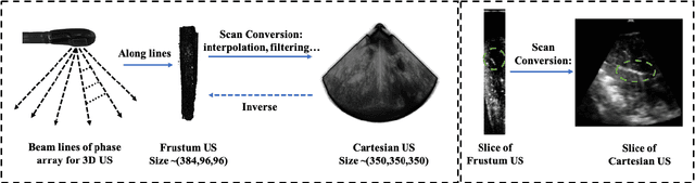 Figure 1 for Weakly-supervised Learning For Catheter Segmentation in 3D Frustum Ultrasound