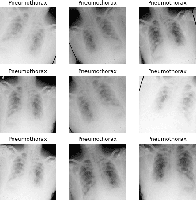 Figure 1 for Developing an App to interpret Chest X-rays to support the diagnosis of respiratory pathology with Artificial Intelligence