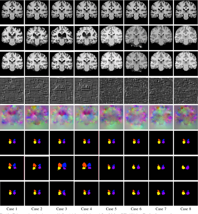 Figure 2 for A Multi-scale Optimization Learning Framework for Diffeomorphic Deformable Registration