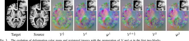 Figure 3 for A Multi-scale Optimization Learning Framework for Diffeomorphic Deformable Registration