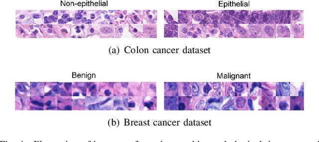 Figure 4 for Distill-to-Label: Weakly Supervised Instance Labeling Using Knowledge Distillation