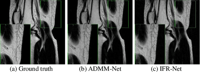 Figure 3 for IFR-Net: Iterative Feature Refinement Network for Compressed Sensing MRI