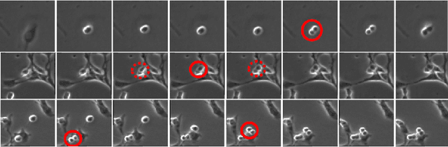 Figure 1 for Spatial-Temporal Mitosis Detection in Phase-Contrast Microscopy via Likelihood Map Estimation by 3DCNN