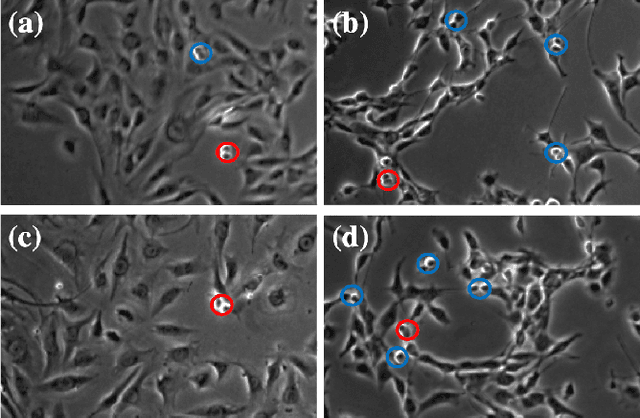 Figure 3 for Spatial-Temporal Mitosis Detection in Phase-Contrast Microscopy via Likelihood Map Estimation by 3DCNN