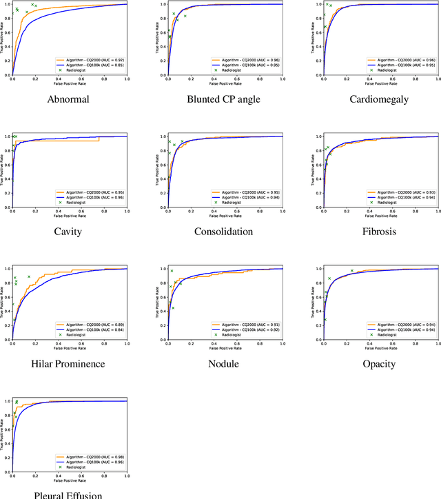 Figure 4 for Can Artificial Intelligence Reliably Report Chest X-Rays?: Radiologist Validation of an Algorithm trained on 1.2 Million X-Rays