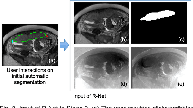 Figure 3 for DeepIGeoS: A Deep Interactive Geodesic Framework for Medical Image Segmentation