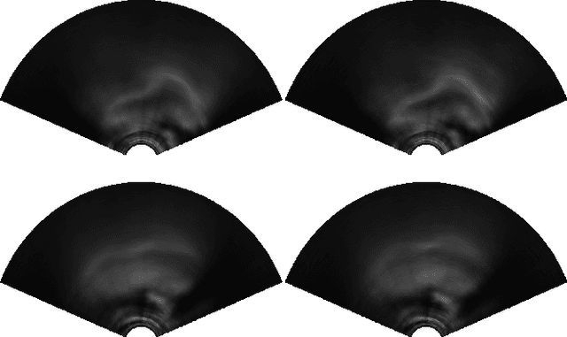 Figure 3 for Speaker-independent classification of phonetic segments from raw ultrasound in child speech