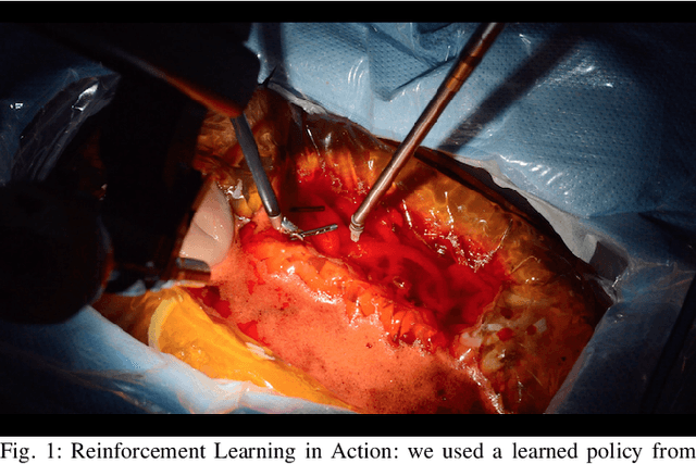 Figure 1 for Open-Sourced Reinforcement Learning Environments for Surgical Robotics