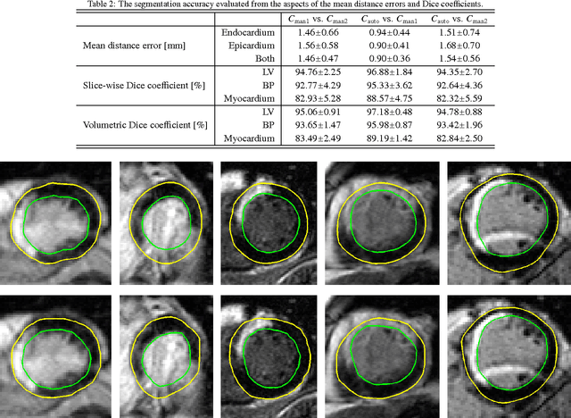 Figure 4 for Three-Dimensional Segmentation of the Left Ventricle in Late Gadolinium Enhanced MR Images of Chronic Infarction Combining Long- and Short-Axis Information