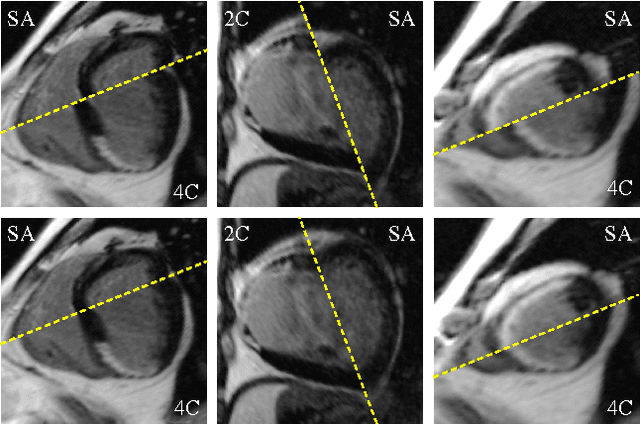 Figure 3 for Three-Dimensional Segmentation of the Left Ventricle in Late Gadolinium Enhanced MR Images of Chronic Infarction Combining Long- and Short-Axis Information
