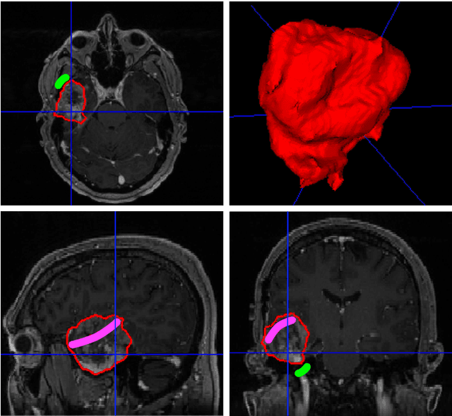 Figure 1 for CAI4CAI: The Rise of Contextual Artificial Intelligence in Computer Assisted Interventions