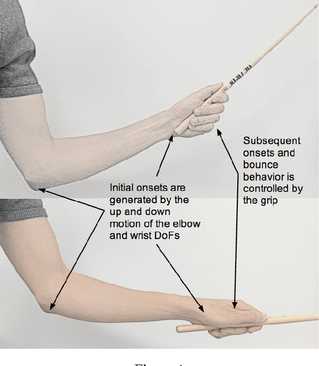 Figure 1 for A Robotic Prosthesis for an Amputee Drummer