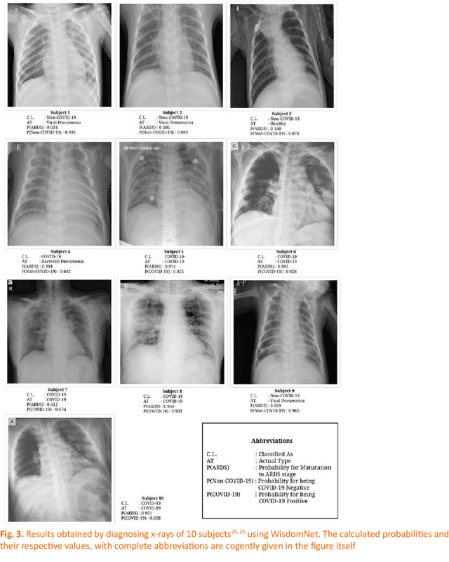 Figure 3 for WisdomNet: Prognosis of COVID-19 with Slender Prospect of False Negative Cases and Vaticinating the Probability of Maturation to ARDS using Posteroanterior Chest X-Rays