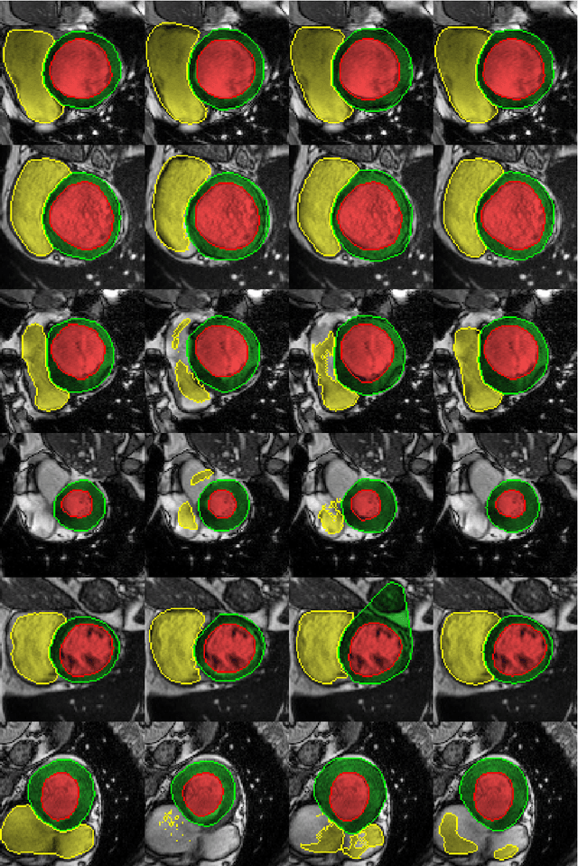 Figure 3 for GridNet with automatic shape prior registration for automatic MRI cardiac segmentation
