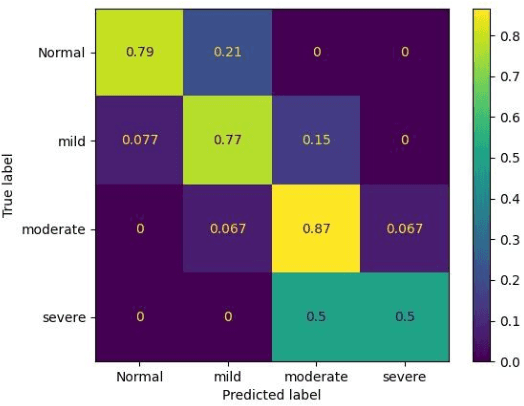 Figure 4 for Improving Hypernasality Estimation with Automatic Speech Recognition in Cleft Palate Speech