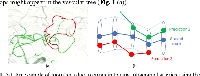 Figure 1 for Deep Open Snake Tracker for Vessel Tracing