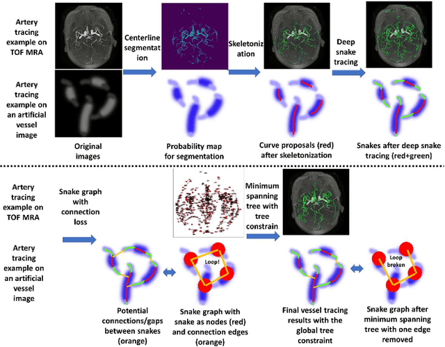 Figure 3 for Deep Open Snake Tracker for Vessel Tracing