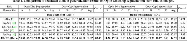 Figure 2 for FedDG: Federated Domain Generalization on Medical Image Segmentation via Episodic Learning in Continuous Frequency Space