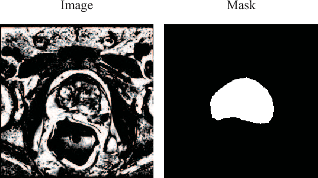 Figure 1 for Prostate Segmentation using 2D Bridged U-net