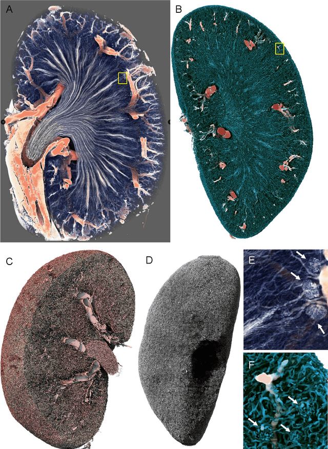 Figure 3 for Terabyte-scale supervised 3D training and benchmarking dataset of the mouse kidney