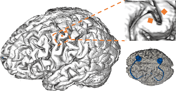 Figure 2 for Dynamic Ensemble Bayesian Filter for Robust Control of a Human Brain-machine Interface