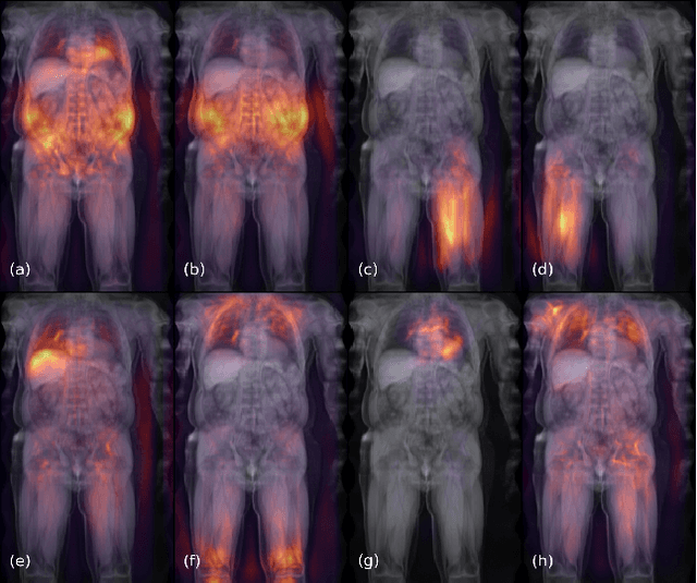 Figure 2 for Deep regression for uncertainty-aware and interpretable analysis of large-scale body MRI